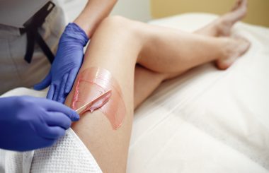 Hair Removal