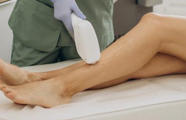 The Future of Hair Removal: Why SHR is Revolutionising the Industry with May Beauty Perth